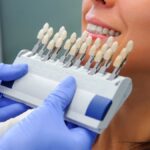 Veneers: The Ultimate Fashion Accessory for Your Smile